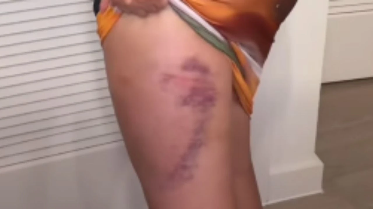 moretes de elsa oseguera