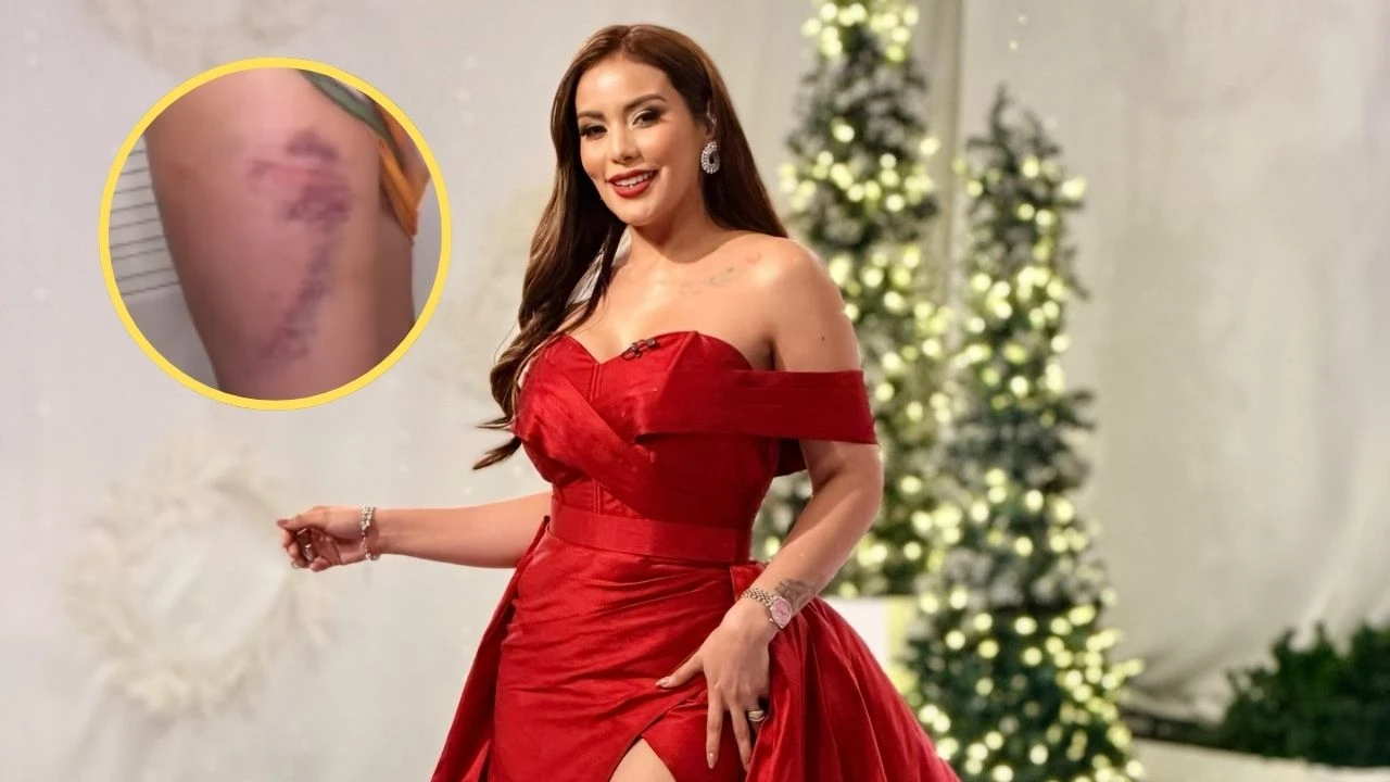 Imagen Principal de Nota: ¿Está bien? Elsa Oseguera muestra moretones en su cuerpo y revela la razón