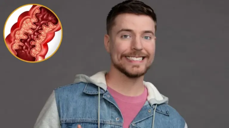 Imagen Principal de Nota: MrBeast, famoso youtuber, padece extraña e incurable enfermedad: ¿de qué se trata?