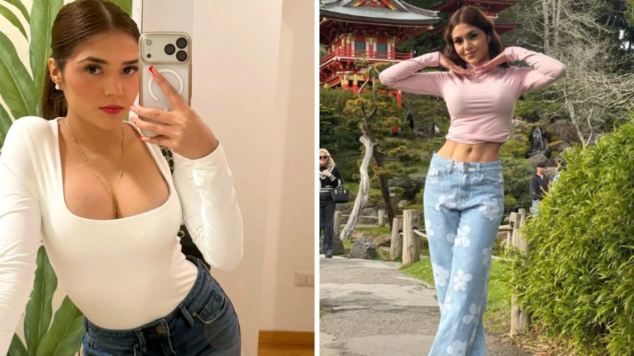 Imagen de 'Soy la Oruga' sorprende con su cambio tras cirugía estética y desata polémica