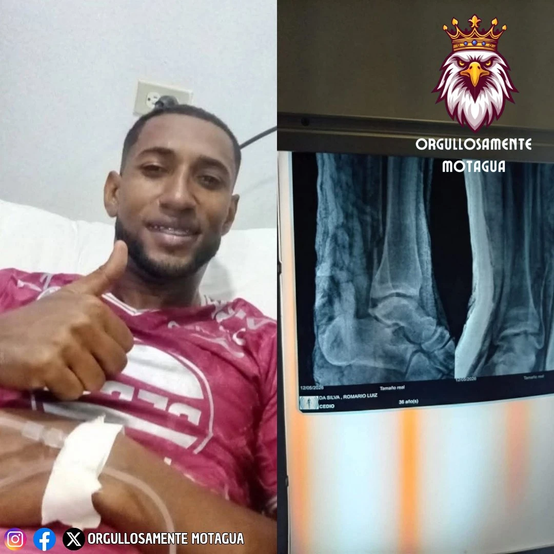 Lesión de Romario Da Silva  