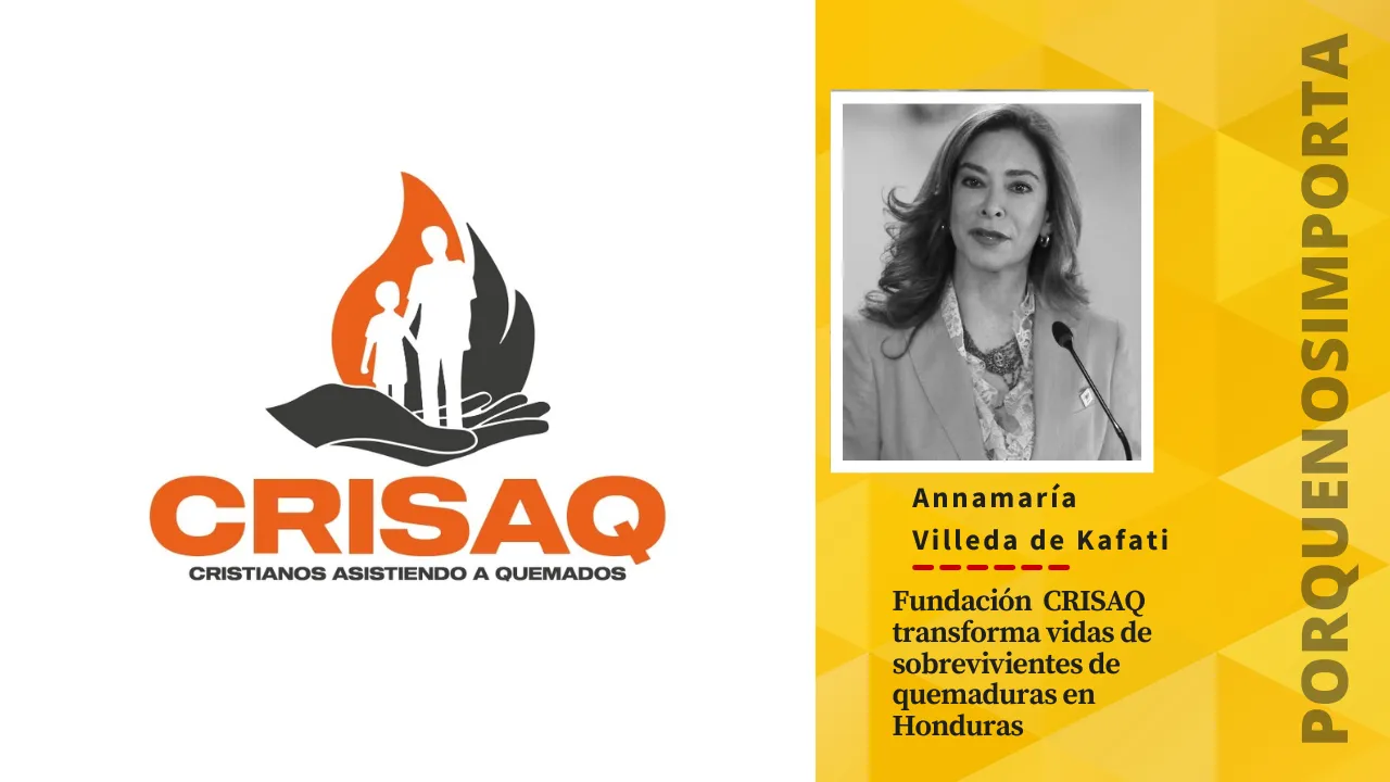 Imagen de Fundación CRISAQ transforma vidas de sobrevivientes de quemaduras en Honduras