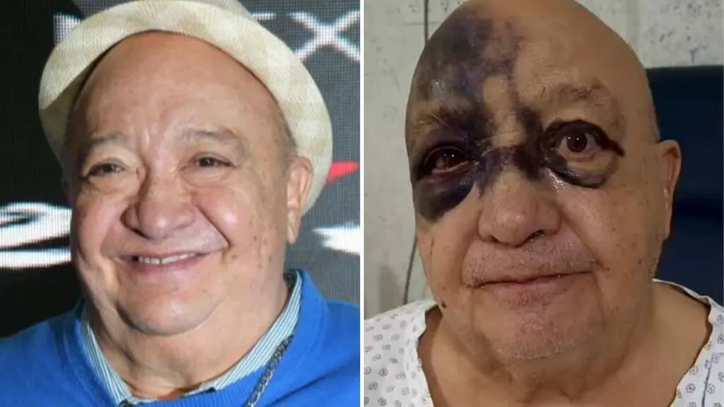 comediante mexicano