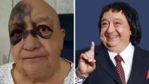 Imagen de ¿Qué le pasó a Luis de Alba? La inesperada aparición con hematomas en la cara