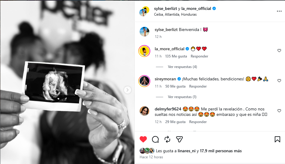 La more junto a su esposa y la ecografía 