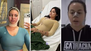 Imagen de Las 5 hondureñas creadoras de contenido que revelaron haberse sometido a cirugías