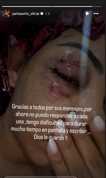 Yaritza Ortiz influencer dominicana atropellada