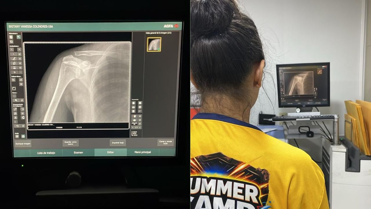 Doctor revela qué tiene Vanessa Barahona tras su lesión en Summer Camp