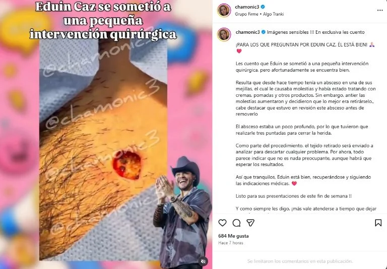 Eduin Caz fue sometido a una cirugía por una lesión en una de sus mejillas, según reportó la periodista Chamonic. Foto: captura de pantalla